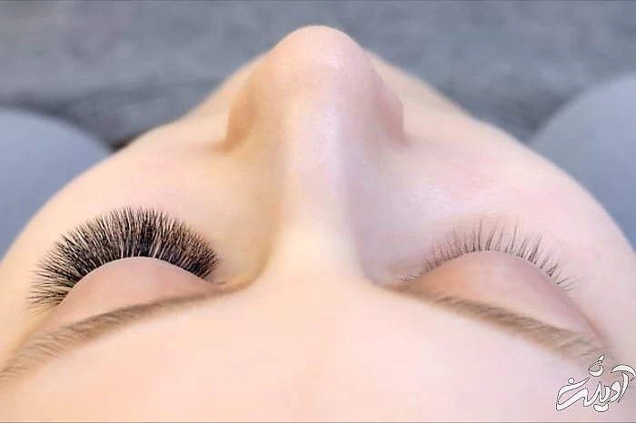 کاشت مژه والیوم